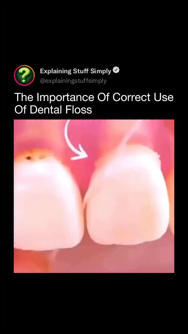 Brushing alone cleans only about 60% of your teeth — the rest of the damage starts between them. Thi…