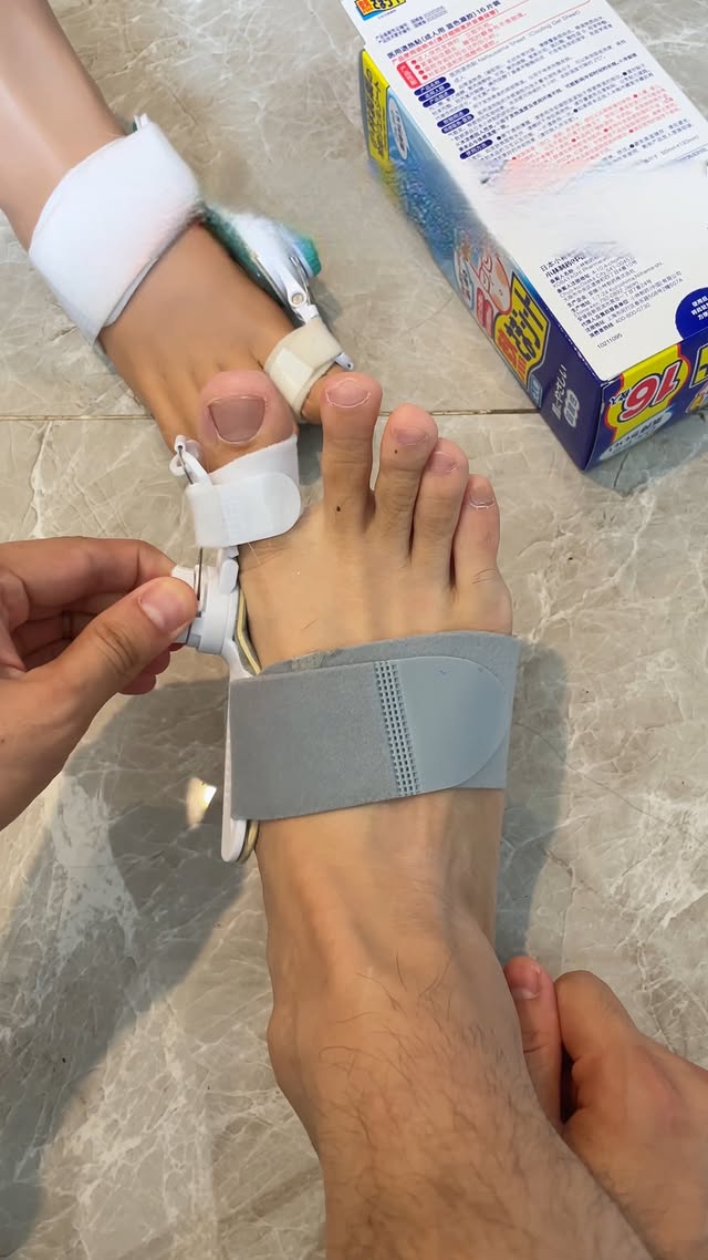 Walk with comfort again 👣✨ Try the Valgus Toe Corrector and feel the difference in your daily routin…